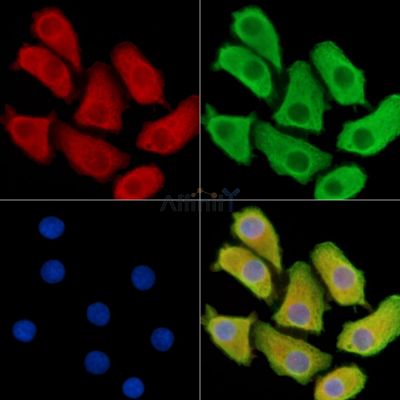 C1orf64 Antibody - DF14267 staining Hela cells by IF/ICC.