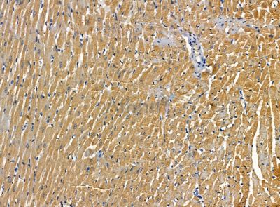 C1orf64 Antibody - DF14267 at 1/100 staining rat heart tissue by IHC-P.