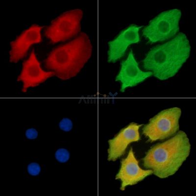 KIF21B Antibody - DF14270 staining Hela cells by IF/ICC.