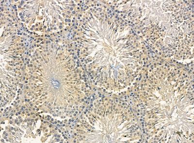 KIF21B Antibody - DF14270 at 1/100 staining rat testis tissue by IHC-P.