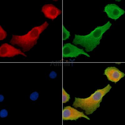 CLSTN2 Antibody - DF14275 staining Hela cells by IF/ICC.