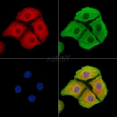 MAP7D3 Antibody - DF14283 staining Hela cells by IF/ICC.