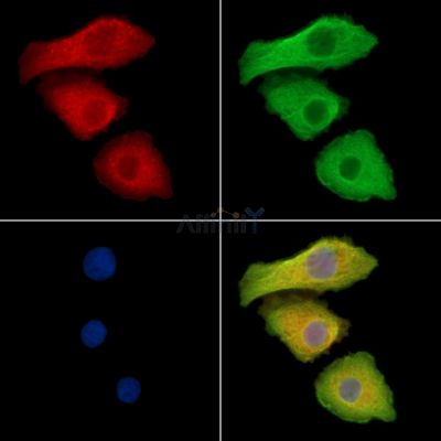PEPP2 Antibody - DF14284 staining Hela cells by IF/ICC.
