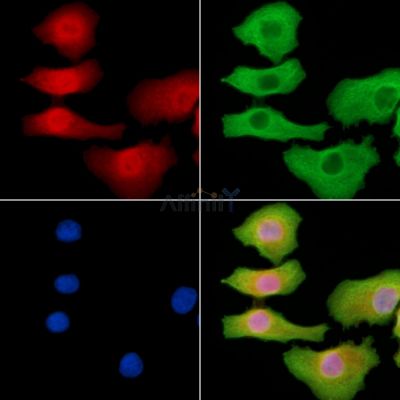 C11orf51 Antibody - DF14288 staining Hela cells by IF/ICC.