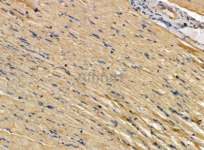 NSP3 Antibody - DF14299 at 1/100 staining rat muscle tissue by IHC-P.