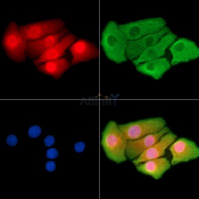 DPY30 Antibody - DF14301 staining Hela cells by IF/ICC.