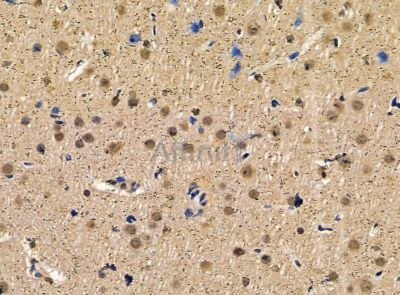 DPY30 Antibody - DF14301 at 1/100 staining rat brain tissue by IHC-P.