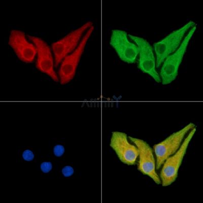 TXNDC4 Antibody - DF14322 staining Hela cells by IF/ICC.