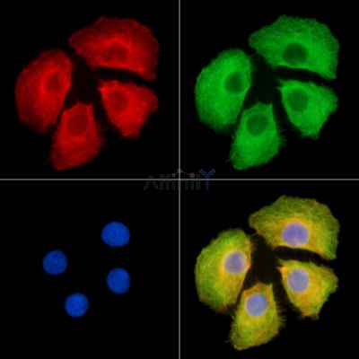 DDX60 Antibody - DF14327 staining Hela cells by IF/ICC.
