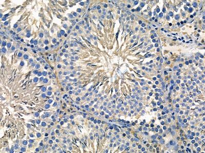 DDX60 Antibody - DF14327 at 1/100 staining rat testis tissue by IHC-P.
