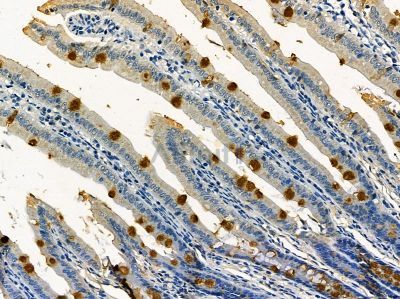 KCP Antibody - DF14328 at 1/100 staining rat colorectal tissue by IHC-P.