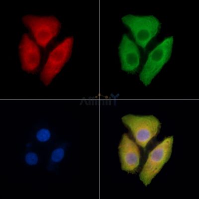 FBXL5 Antibody - DF14329 staining Hela cells by IF/ICC.