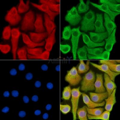 LPHN2 Antibody - DF14330 staining Hela cells by IF/ICC.