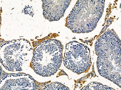 LPHN2 Antibody - DF14330 at 1/100 staining mouse testis tissue by IHC-P.