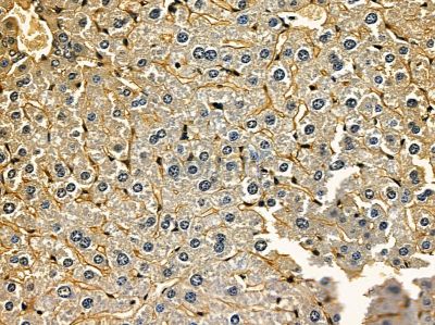 XPR1 Antibody - DF14331 at 1/100 staining mouse liver tissue by IHC-P.
