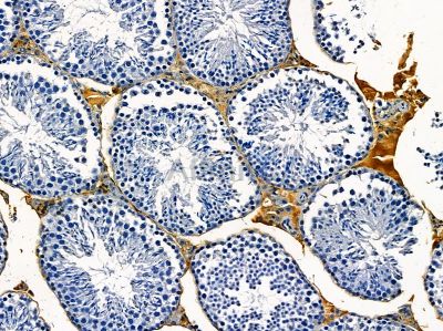XPR1 Antibody - DF14331 at 1/100 staining mouse testis tissue by IHC-P.