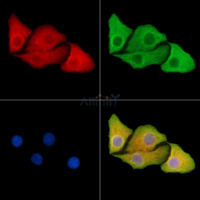 ALG3 Antibody - DF14333 staining Hela cells by IF/ICC.