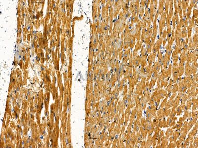 CPA3 Antibody - DF14338 at 1/100 staining rat heart tissue by IHC-P.