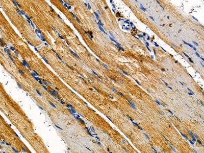 CPA3 Antibody - DF14338 at 1/100 staining rat muscle tissue by IHC-P.