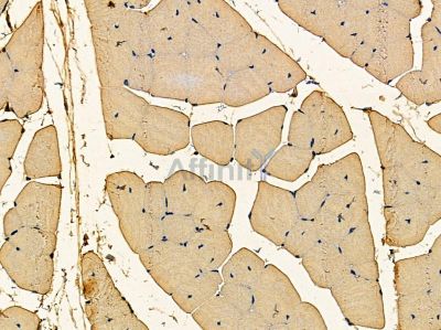 ChT1 Antibody - DF14348 at 1/100 staining mouse muscle tissue by IHC-P.