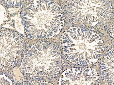 ChT1 Antibody - DF14348 at 1/100 staining rat testis tissue by IHC-P.