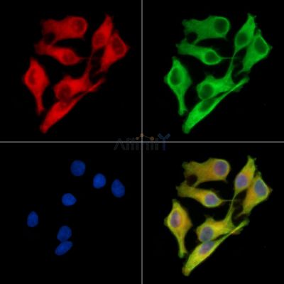 TPD52 Antibody - DF14353 staining Hela cells by IF/ICC.