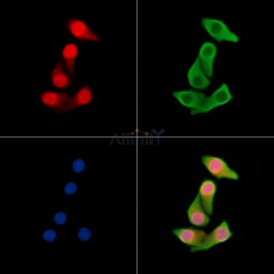 UBXN7 Antibody - DF14368 staining Hela cells by IF/ICC.
