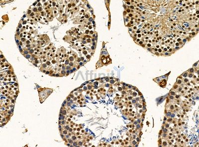 UBXN7 Antibody - DF14368 at 1/100 staining mouse testis tissue by IHC-P.