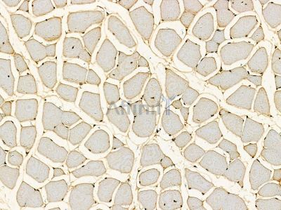 SPNXA Antibody - DF14385 at 1/100 staining mouse muscle tissue by IHC-P.
