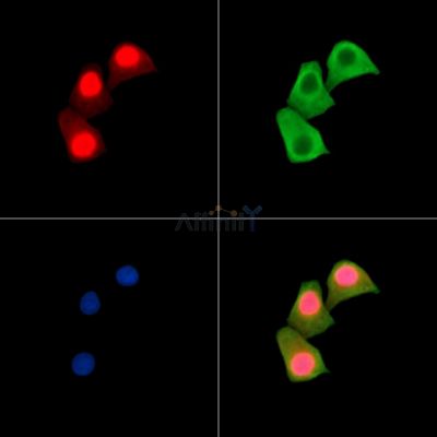 TIP120A Antibody - DF14388 staining Hela cells by IF/ICC.