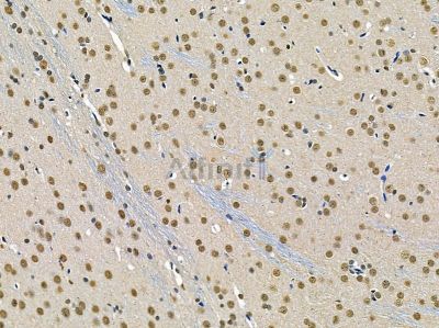 TIP120A Antibody - DF14388 at 1/100 staining rat brain tissue by IHC-P.