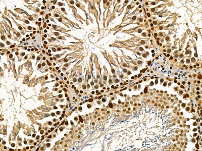 TIP120A Antibody - DF14388 at 1/100 staining rat testis tissue by IHC-P.