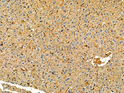 SNX16 Antibody - DF14412 at 1/100 staining mouse liver tissue by IHC-P.