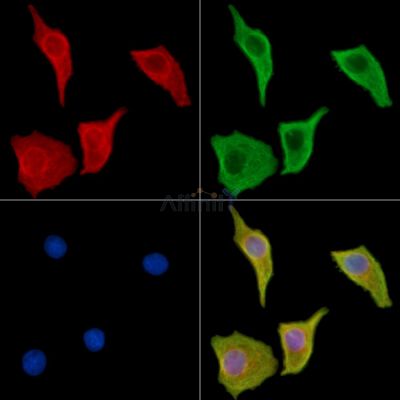 VPS18 Antibody - DF14415 staining Hela cells by IF/ICC.