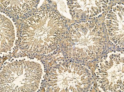 VPS18 Antibody - DF14415 at 1/100 staining rat testis tissue by IHC-P.