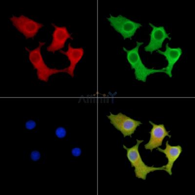 IREB2 Antibody - DF14436 staining Hela cells by IF/ICC.