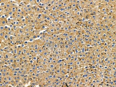 IREB2 Antibody - DF14436 at 1/100 staining mouse liver tissue by IHC-P.