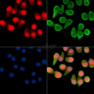 ZNF562 Antibody - DF14444 staining Hela cells by IF/ICC.