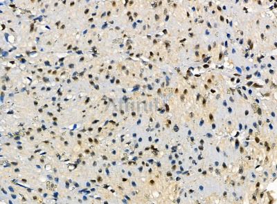 PTPN13 Antibody - DF14453 at 1/100 staining rat stomach tissue by IHC-P.