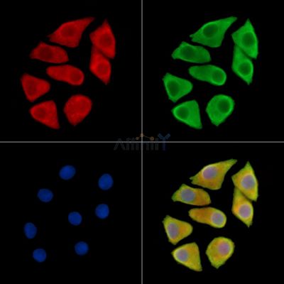 TIFA Antibody - DF14456 staining Hela cells by IF/ICC.