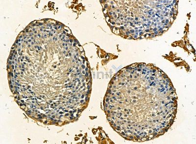 TIFA Antibody - DF14456 at 1/100 staining mouse testis tissue by IHC-P.