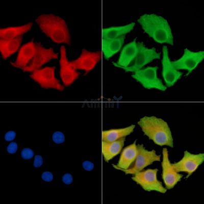 SET1A Antibody - DF14472 staining Hela cells by IF/ICC.