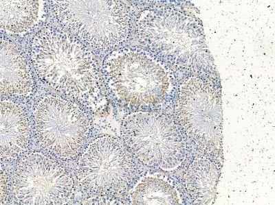 SET1A Antibody - DF14472 at 1/100 staining rat testis tissue by IHC-P.