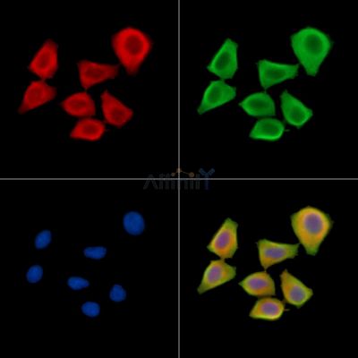 RBP3 Antibody - DF14479 staining Hela cells by IF/ICC.