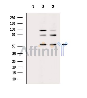 DDX49 Antibody - Western blot analysis of extracts from various samples, using DDX49 Antibody.