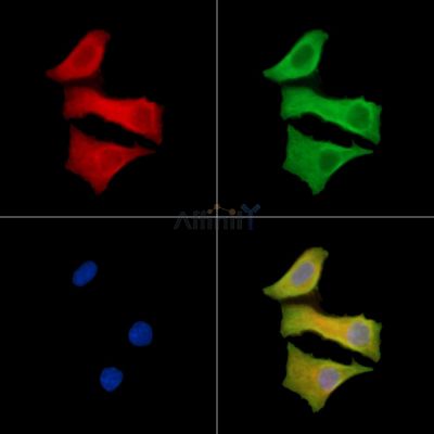 DDX49 Antibody - DF14485 staining Hela cells by IF/ICC.