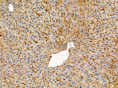 DDX49 Antibody - DF14485 at 1/100 staining mouse liver tissue by IHC-P.