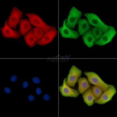 PACRG Antibody - DF14489 staining Hela cells by IF/ICC.