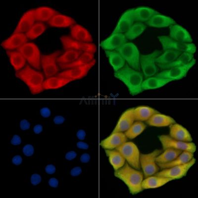 TRIM13 Antibody - DF14490 staining Hela cells by IF/ICC.