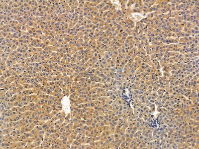 ALOX15B Antibody - DF14500 at 1/100 staining rat heart tissue by IHC-P.
